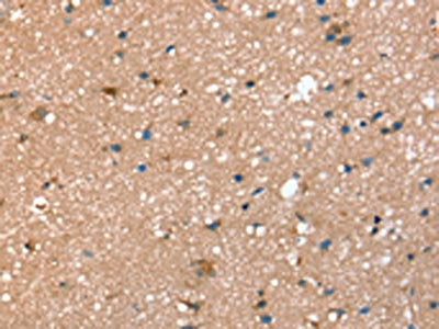 The image on the left is immunohistochemistry of paraffin-embedded Human brain  tissue using STX2 Antibody(STX2 Antibody) at dilution 1/40, on the right is treated with synthetic peptide. (Original magnification: ×200)Rabbit anti-Human STX2 Polyclonal Antibody