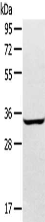 Gel: 8%SDS-PAGE, Lysate: 40 μg, Lane: A172 cells, Primary antibody: STX2 Antibody(STX2 Antibody) at dilution 1/400, Secondary antibody: Goat anti rabbit IgG at 1/8000 dilution, Exposure time: 2 minutesRabbit anti-Human STX2 Polyclonal Antibody