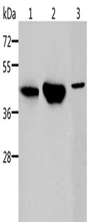 Gel: 10%SDS-PAGE, Lysate: 40 μg, Lane 1-3: Mouse kidney tissue, human normal kidney tissue, K562 cells, Primary antibody: ACY1 Antibody(ACY1 Antibody) at dilution 1/250, Secondary antibody: Goat anti rabbit IgG at 1/8000 dilution, Exposure time: 2 minutesRabbit anti-Human ACY1 Polyclonal Antibody