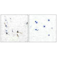 Immunohistochemical analysis of paraffin-embedded human brain tissue using Potassium Channel Kv3.2b antibody.