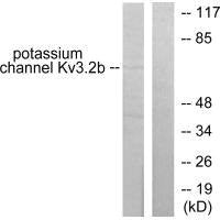 Western blot analysis of extracts from HepG2 cells, using Potassium Channel Kv3.2b antibody.