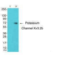 Western blot analysis of extracts from 293 cells (Lane 2), using Potassium Channel Kv3.2b antiobdy. The lane on the left is treated with synthesized peptide.