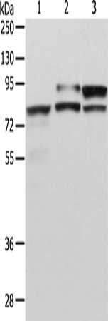 Gel: 8%SDS-PAGE, Lysate: 40 μg, Lane 1-3: Human liver cancer tissue, NIH/3T3 cells, Jurkat cells, Primary antibody: ADAM15 Antibody(ADAM15 Antibody) at dilution 1/300, Secondary antibody: Goat anti rabbit IgG at 1/8000 dilution, Exposure time: 5 minutes