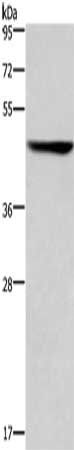 Gel: 8%SDS-PAGE, Lysate: 40 μg, Lane: Hela cells, Primary antibody: KRT16 Antibody(KRT16 Antibody) at dilution 1/450, Secondary antibody: Goat anti rabbit IgG at 1/8000 dilution, Exposure time: 20 seconds