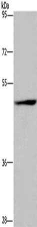 Gel: 6%SDS-PAGE, Lysate: 50 μg, Lane: Jurkat cells, Primary antibody: SIGLEC9 Antibody(SIGLEC9 Antibody) at dilution 1/350, Secondary antibody: Goat anti rabbit IgG at 1/8000 dilution, Exposure time: 30 secondsRabbit anti-Human SIGLEC9 Polyclonal Antibody