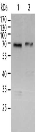 Gel: 10%SDS-PAGE, Lysate: 40 μg, Lane 1-2: A431 cells, Jurkat cells, Primary antibody: RELA Antibody(RELA Antibody) at dilution 1/300, Secondary antibody: Goat anti rabbit IgG at 1/8000 dilution, Exposure time: 1 minuteRabbit anti-Human RELA Polyclonal Antibody