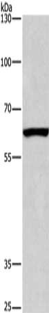 Gel: 6%SDS-PAGE, Lysate: 40 μg, Lane: Mouse testis tissue, Primary antibody: ARMCX2 Antibody(ARMCX2 Antibody) at dilution 1/425, Secondary antibody: Goat anti rabbit IgG at 1/8000 dilution, Exposure time: 40 seconds