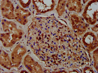 IHC image of CKAP5 Antibody diluted at 1:400 and staining in paraffin-embedded human kidney tissue performed on a Leica BondTM system. After dewaxing and hydration, antigen retrieval was mediated by high pressure in a citrate buffer (pH 6.0). Section was blocked with 10% normal goat serum 30min at RT. Then primary antibody (1% BSA) was incubated at 4°C overnight. The primary is detected by a biotinylated secondary antibody and visualized using an HRP conjugated SP system.Rabbit anti-Human CKAP5 Polyclonal Antibody