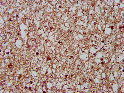 IHC image of CKAP5 Antibody diluted at 1:400 and staining in paraffin-embedded human brain tissue performed on a Leica BondTM system. After dewaxing and hydration, antigen retrieval was mediated by high pressure in a citrate buffer (pH 6.0). Section was blocked with 10% normal goat serum 30min at RT. Then primary antibody (1% BSA) was incubated at 4°C overnight. The primary is detected by a biotinylated secondary antibody and visualized using an HRP conjugated SP system.Rabbit anti-Human CKAP5 Polyclonal Antibody