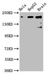 Western Blot  | Positive WB detected in: Hela whole cell lysate, HepG2 whole cell lysate, Rat brain tissue  | All lanes: CKAP5 antibody at 6µg/ml  | Secondary  | Goat polyclonal to rabbit IgG at 1/50000 dilution  | Predicted band size: 226, 219, 227 kDa  | Observed band size: 226 kDaRabbit anti-Human CKAP5 Polyclonal Antibody