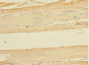 Immunohistochemistry of paraffin-embedded human skeletal muscle tissue using TOB2 Antibody at dilution of 1:100Rabbit anti-Human TOB2 Polyclonal Antibody