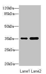 Western blot | All lanes: TOB2 antibody at 1.89μg/ml | Lane 1: Mouse skeletal muscle tissue | Lane 2: Mouse heart tissue | Secondary | Goat polyclonal to rabbit IgG at 1/10000 dilution | Predicted band size: 37, 28 kDa | Observed band size: 37 kDaRabbit anti-Human TOB2 Polyclonal Antibody