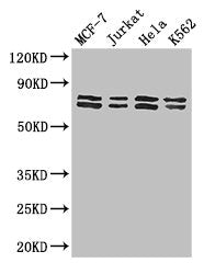 Western Blot | Positive WB detected in: MCF-7 whole cell lysate, Jurkat whole cell lysate, Hela whole cell lysate, K562 whole cell lysate | All lanes: TRIM25 antibody at 3μg/ml | Secondary | Goat polyclonal to rabbit IgG at 1/50000 dilution | Predicted band size: 71 kDa | Observed band size: 71, 80 kDa