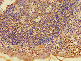 Immunohistochemistry of paraffin-embedded human tonsil tissue using FKBP8 Antibody at dilution of 1:100Rabbit anti-Human FKBP8 Polyclonal Antibody