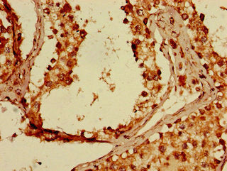 Immunohistochemistry of paraffin-embedded human testis tissue using FKBP8 Antibody at dilution of 1:100Rabbit anti-Human FKBP8 Polyclonal Antibody
