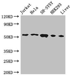 Western Blot | Positive WB detected in: Jurkat whole cell lysate, Hela whole cell lysate, SH-SY5Y whole cell lysate, HEK293 whole cell lysate, Mouse liver tissue | All lanes: FKBP8 antibody at 3μg/ml | Secondary | Goat polyclonal to rabbit IgG at 1/50000 dilution | Predicted band size: 45, 28 kDa | Observed band size: 55 kDaRabbit anti-Human FKBP8 Polyclonal Antibody