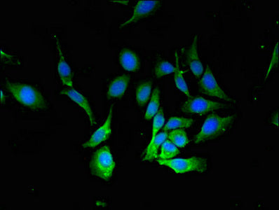 Immunofluorescence staining of Hela cells with BECN1 Antibody at 1:133, counter-stained with DAPI. The cells were fixed in 4% formaldehyde, permeabilized using 0.2% Triton X-100 and blocked in 10% normal Goat Serum. The cells were then incubated with the antibody overnight at 4°C. The secondary antibody was Alexa Fluor 488-congugated AffiniPure Goat Anti-Rabbit IgG(H+L).