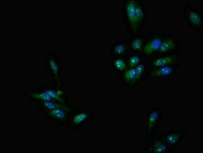 Immunofluorescent analysis of Hela cells using DMC1 Antibody at dilution of 1:100 and Alexa Fluor 488-congugated AffiniPure Goat Anti-Rabbit IgG(H+L)Rabbit anti-Human DMC1 Polyclonal Antibody