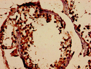 Immunohistochemistry analysis of human testis tissue using DMC1 Antibody at dilution of 1:100Rabbit anti-Human DMC1 Polyclonal Antibody
