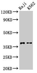 Western Blot  | Positive WB detected in: Raji whole cell lysate, K562 whole cell lysate  | All lanes: DMC1 antibody at 3.2µg/ml  | Secondary  | Goat polyclonal to rabbit IgG at 1/50000 dilution  | Predicted band size: 38, 32 kDa  | Observed band size: 38 kDaRabbit anti-Human DMC1 Polyclonal Antibody