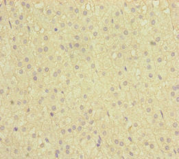 Immunohistochemistry of paraffin-embedded human adrenal gland tissue using NAA25 Antibody at dilution of 1:100Rabbit anti-Human NAA25 Polyclonal Antibody