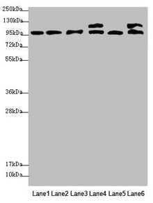 Western blot  | All lanes: NAA25 antibody at 2.12µg/ml  | Lane 1: Mouse liver tissue  | Lane 2: Mouse kidney tissue  | Lane 3: Hela whole cell lysate  | Lane 4: 293T whole cell lysate  | Lane 5: A549 whole cell lysate  | Lane 6: HepG2 whole cell lysate  | Secondary  | Goat polyclonal to rabbit IgG at 1/10000 dilution  | Predicted band size: 113, 100 kDa  | Observed band size: 113, 100 kDaRabbit anti-Human NAA25 Polyclonal Antibody