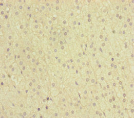 Immunohistochemistry of paraffin-embedded human adrenal gland tissue using NAA25 Antibody at dilution of 1:100Rabbit anti-Human NAA25 Polyclonal Antibody