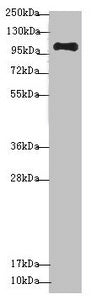 Western blot | All lanes: NAA25 antibody at 1.36 μg/ml + Mouse kidney tissue | Secondary | Goat polyclonal to rabbit IgG at 1/10000 dilution | Predicted band size: 113, 100 kDa | Observed band size: 113 kDaRabbit anti-Human NAA25 Polyclonal Antibody