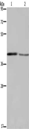 Gel: 8%SDS-PAGE, Lysate: 40 μg, Lane 1-2: Mouse small intestine tissue, Mouse skin tissue, Primary antibody: DEGS1 Antibody(DEGS1 Antibody) at dilution 1/450, Secondary antibody: Goat anti rabbit IgG at 1/8000 dilution, Exposure time: 5 minutesRabbit anti-Human DEGS1 Polyclonal Antibody