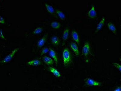 Immunofluorescent analysis of Hela cells using SPCS2 Antibody at dilution of 1:100 and Alexa Fluor 488-congugated AffiniPure Goat Anti-Rabbit IgG(H+L)Rabbit anti-Human SPCS2 Polyclonal Antibody