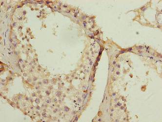 Immunohistochemistry of paraffin-embedded human testis tissue using SPCS2 Antibody at dilution of 1:100Rabbit anti-Human SPCS2 Polyclonal Antibody