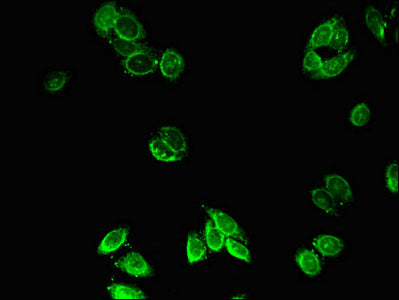 Immunofluorescent analysis of HepG2 cells using ACOX1 Antibody at dilution of 1:100 and Alexa Fluor 488-congugated AffiniPure Goat Anti-Rabbit IgG(H+L)
