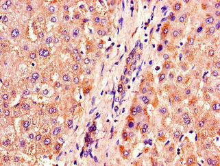 Immunohistochemistry of paraffin-embedded human liver tissue using ACOX1 Antibody at dilution of 1:100