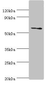 Western blot | All lanes: DHCR24 antibody at 2μg/ml + Jurkat whole cell lysate | Secondary | Goat polyclonal to rabbit IgG at 1/10000 dilution | Predicted band size: 61, 55 kDa | Observed band size: 61 kDaRabbit anti-Human DHCR24 Polyclonal Antibody