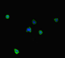 Immunofluorescent analysis of HepG2 cells using STIL Antibody at dilution of 1:100 and Alexa Fluor 488-congugated AffiniPure Goat Anti-Rabbit IgG(H+L)Rabbit anti-Human STIL Polyclonal Antibody