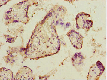 Immunohistochemistry of paraffin-embedded human placenta tissue using ELF2 Antibody at dilution of 1:100Rabbit anti-Human ELF2 Polyclonal Antibody