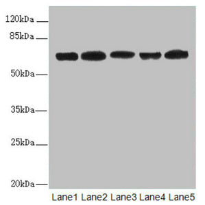 Western blot | All lanes: ELF2 antibody at 2.27μg/ml | Lane 1: HL60 whole cell lysate | Lane 2: A549 whole cell lysate | Lane 3: MCF-7 whole cell lysate | Lane 4: Jurkat whole cell lysate | Lane 5: Hela whole cell lysate | Secondary | Goat polyclonal to rabbit IgG at 1/10000 dilution | Predicted band size: 64, 63, 57, 58, 55 kDa | Observed band size: 64, 50 kDaRabbit anti-Human ELF2 Polyclonal Antibody