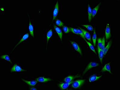 Immunofluorescent analysis of Hela cells using NEDD8 Antibody at dilution of 1:100 and Alexa Fluor 488-congugated AffiniPure Goat Anti-Rabbit IgG(H+L)Rabbit anti-Human NEDD8 Polyclonal Antibody