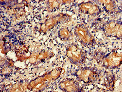 Immunohistochemistry of paraffin-embedded human small intestine tissue using UAP1 Antibody at dilution of 1:100Rabbit anti-Human UAP1 Polyclonal Antibody