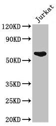 Western Blot  | Positive WB detected in: Jurkat whole cell lysate  | All lanes: UAP1 antibody at 2.5µg/ml  | Secondary  | Goat polyclonal to rabbit IgG at 1/50000 dilution  | Predicted band size: 59, 58 kDa  | Observed band size: 59 kDaRabbit anti-Human UAP1 Polyclonal Antibody