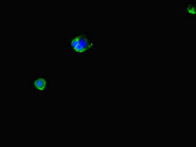 Immunofluorescent analysis of MCF-7 cells using LPAL2 Antibody at dilution of 1:100 and Alexa Fluor 488-congugated AffiniPure Goat Anti-Rabbit IgG(H+L)Rabbit anti-Human LPAL2 Polyclonal Antibody