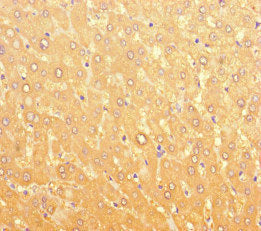 Immunohistochemistry of paraffin-embedded human liver tissue using LPAL2 Antibody at dilution of 1:100Rabbit anti-Human LPAL2 Polyclonal Antibody
