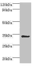 Western blot | All lanes: Aminoacyl tRNA synthase complex-interacting multifunctional protein 1 antibody at 2μg/ml + HepG2 whole cell lysate | Secondary | Goat polyclonal to rabbit IgG at 1/10000 dilution | Predicted band size: 35, 38 kDa | Observed band size: 35 kDaRabbit anti-Human AIMP1 Polyclonal Antibody