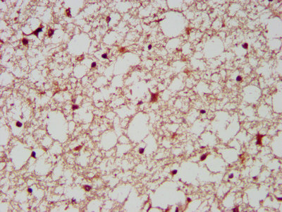 IHC image of AIMP1 Antibody diluted at 1:200 and staining in paraffin-embedded human brain tissue performed on a Leica BondTM system. After dewaxing and hydration, antigen retrieval was mediated by high pressure in a citrate buffer (pH 6.0). Section was blocked with 10% normal goat serum 30min at RT. Then primary antibody (1% BSA) was incubated at 4°C overnight. The primary is detected by a biotinylated secondary antibody and visualized using an HRP conjugated SP system.Rabbit anti-Human AIMP1 Polyclonal Antibody