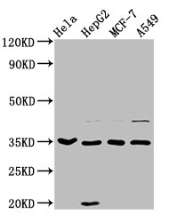 Western Blot  | Positive WB detected in: Hela whole cell lysate, HepG2 whole cell lysate, MCF-7 whole cell lysate, A549 whole cell lysate  | All lanes: AIMP1 antibody at 3.7µg/ml  | Secondary  | Goat polyclonal to rabbit IgG at 1/50000 dilution  | Predicted band size: 35, 38 kDa  | Observed band size: 35 kDaRabbit anti-Human AIMP1 Polyclonal Antibody