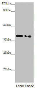 Western blot  | All lanes: PPP1R8 antibody at 1.11µg/ml  | Lane 1: PC-3 whole cell lysate  | Lane 2: HL60 whole cell lysate  | Secondary  | Goat polyclonal to rabbit IgG at 1/10000 dilution  | Predicted band size: 39, 23, 14 kDa  | Observed band size: 39 kDaRabbit anti-Human PPP1R8 Polyclonal Antibody