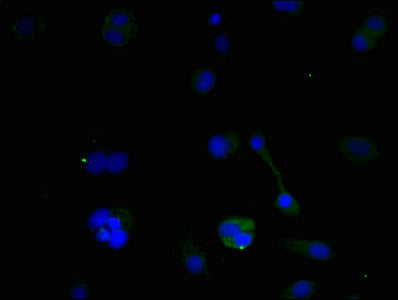 Immunofluorescent analysis of MCF-7 cells using BNIP3 Antibody at dilution of 1:100 and Alexa Fluor 488-congugated AffiniPure Goat Anti-Rabbit IgG(H+L)