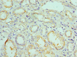 Immunohistochemistry of paraffin-embedded human kidney tissue using BNIP3 Antibody at dilution of 1:100