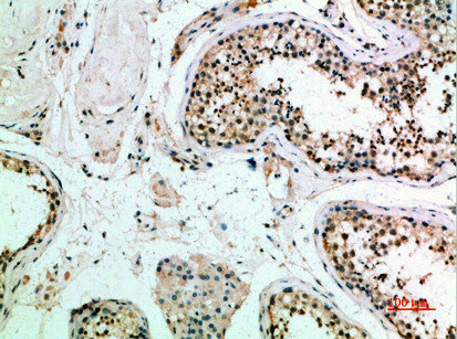 Immunohistochemical analysis of paraffin-embedded human-testis, antibody was diluted at 1:200Rabbit anti-Human FZD9 Polyclonal Antibody