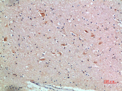Immunohistochemical analysis of paraffin-embedded human-brain, antibody was diluted at 1:200Rabbit anti-Human FZD9 Polyclonal Antibody
